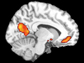 brain regions