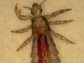 a blood-engorged head louse