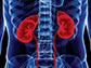 News thumbnail of x-ray of kidneys