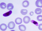 the malaria parasite Plasmodium falciparum