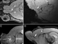 the migration of neuroblasts