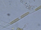 Pseudo-nitschia cells