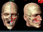 facial reconstruction models