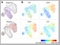 viSNE reveals the progression of cancer