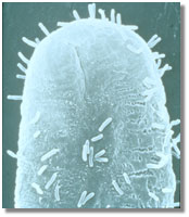 The Agrobacterium tumefaciens microbe