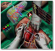 3D graphical reconstruction of surgery, caption is below