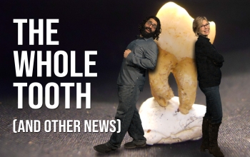 the whole tooth, two people leaning against a cast of a tooth