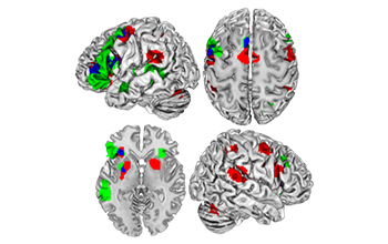 An fMRI image of the human brain showing when it is active in response to rhythm and grammar.