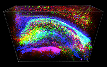 NSF-funded scientists developed a new imaging technology to see into the brain.