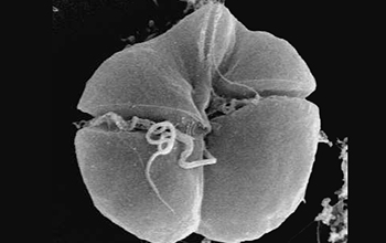The microscopic plankton Karenia brevis is responsible for the Florida harmful algae bloom.