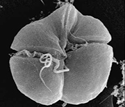 The microscopic plankton Karenia brevis is responsible for the Florida harmful algae bloom.