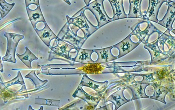seawater viewed under microscope
