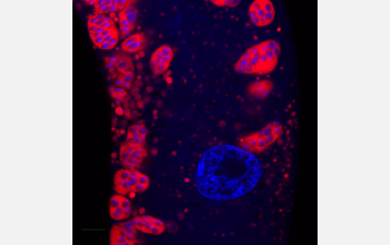 Roundworm intestine stained to reveal a newly discovered species of microsporidia cytoplasm.