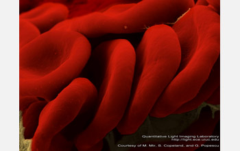 white blood cells under electron microscope