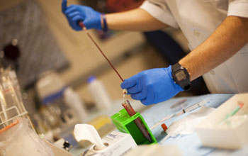 Mixing blood with test particles as part of on-going research on new drug delivery carriers