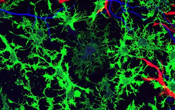 glial cells in a mouse brain