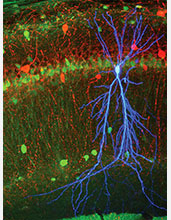 A stained pyramidal cell (shown in blue) in area CA1--a part of the hippocampus that is thought to be an important relay station for memories--of the mouse hippocampus.