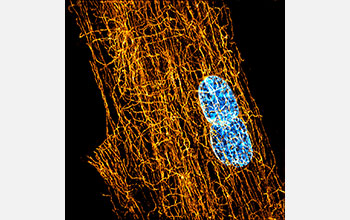 Cage of microtubules surrounds nucleus in a human heart cell