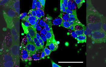 Confocal microscopy image of human embryonic kidney cells