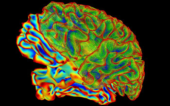 Multi-color image of a whole brain