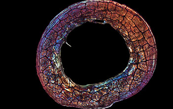 Microscopic image of mid-shaft section of primate femur
