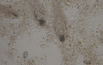 The larval stage of a parasite in its host clam, Abra segmentum.