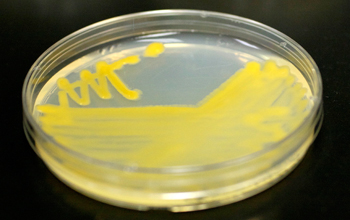 Photo of a petri plate containing bacteria harvested from amoebae.