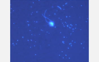 Epifluorescence microscope image of bacterioplankton and a flagellate in seawater.