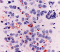 Immunohistochemical staining of rabies virus antigens in an infected animal brain.