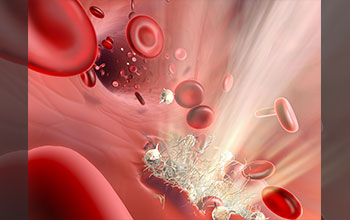 Red blood cells flow past a tear in the blood vessel