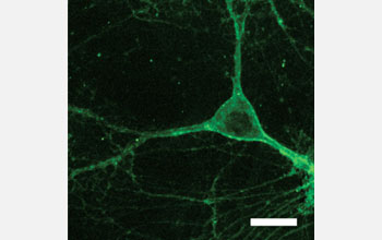 a mouse neuron taking on the characteristics of an Arch gene.