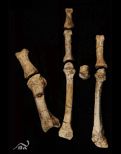 Photo of the Burtele partial foot after cleaning and preparation.