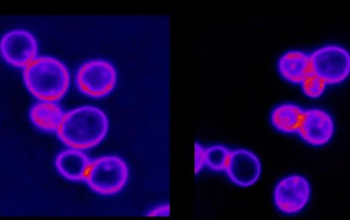 Aneuploid yeast cells