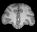 MRI scan of a 15 year-old male chimpanzee brain.