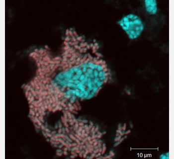 A microscope photograph shows the bacterium in cockroaches that helps them store uric acid.