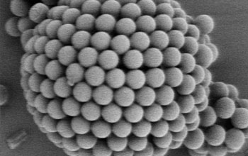 Multimedia Gallery - An electron microscope image of a colloidosome. | NSF  - National Science Foundation