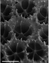 Scanning electron micrograph showing the calcium carbonate matrix of coral.