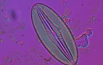 diatom under a microscope