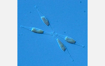 Micrograph of the fusiform morphotype of the diatom Phaeodactylum tricornutum.