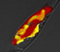 Micrograph of the marine diatom Phaeodactylum tricornutum overexpressing a urea cycle protein.