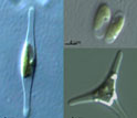 Micrographs, clockwise from top right, of oval, triradiate and fusiform P. tricornutum morphotypes.