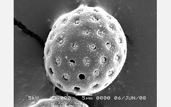 Scanning electron image of saltbush pollen.