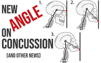 New angle on concussion and other news, skull at different angles and top of spine