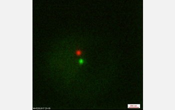 red and green fluorescent spots indicating the location of a yeast cell chromosome.