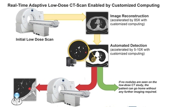 diagram showing how real-time adaptive low-dose CT-scan enabled by customized computing works