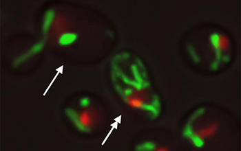 yeast cells with the same DNA