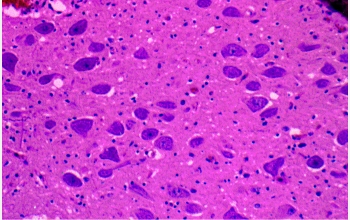 Slide showing tissue from the brain of a healthy mule deer