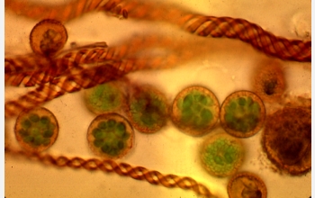 Spores from the liverwort <em>Podomitrium phyllanthus</em>