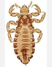 An image taken through a microscope shows a head louse up close and personal.