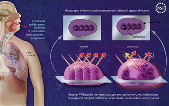 Illustration showing nano-scale disturbances in cheek cells indicate the presence of lung cancer